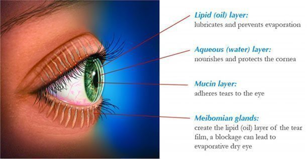 dry-eye-diagram