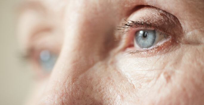 cataract surgery